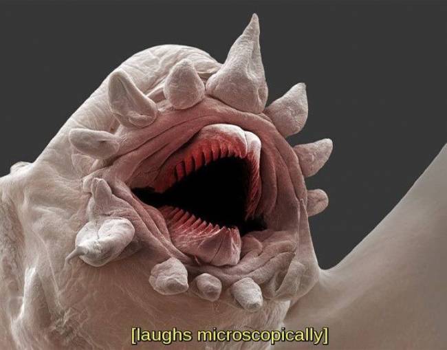 [laughs microscopically]